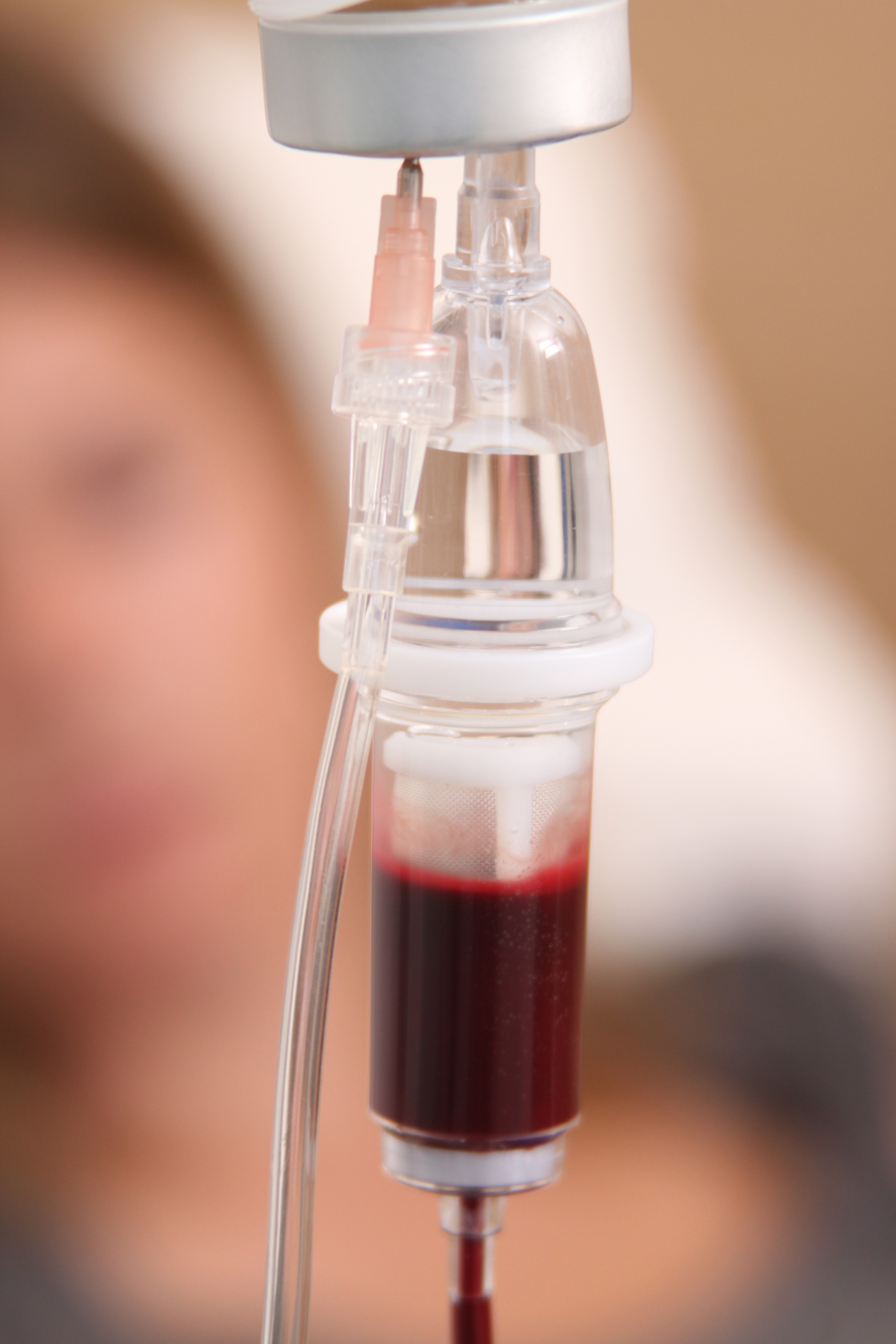 Flasche mit Blut bei der Ozontherapie